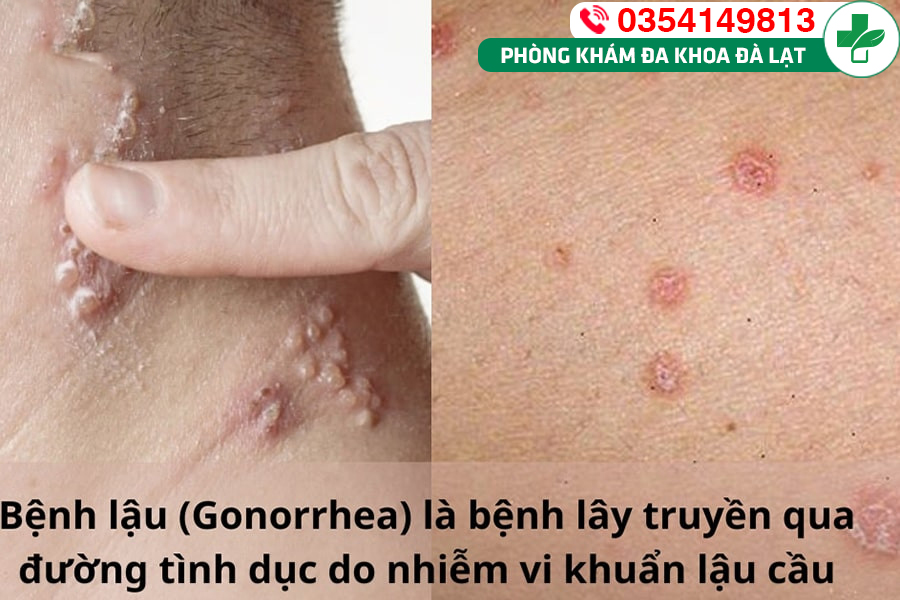 Hình ảnh minh họa